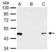 Anti-RFP antibody used in Immunoprecipitation (IP). GTX127897