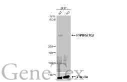 Anti-HYPB/SETD2 antibody used in Western Blot (WB). GTX127905