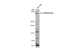 Anti-HYPB/SETD2 antibody used in Western Blot (WB). GTX127906