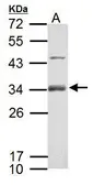 Anti-RSPO1 antibody used in Western Blot (WB). GTX127912
