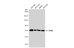 Anti-PAK6 antibody used in Western Blot (WB). GTX127915