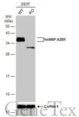 Anti-hnRNP A2B1 antibody used in Western Blot (WB). GTX127928