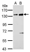 Anti-NFAT1 antibody used in Western Blot (WB). GTX127932