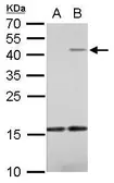 Anti-IL22 antibody used in Western Blot (WB). GTX127938