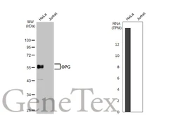 Anti-OPG antibody used in Western Blot (WB). GTX127948