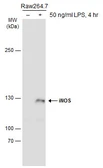 Anti-iNOS antibody used in Western Blot (WB). GTX127952