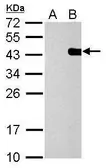 Anti-PITX2 antibody used in Western Blot (WB). GTX127973
