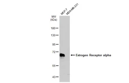 Anti-Estrogen Receptor alpha antibody used in Western Blot (WB). GTX127978
