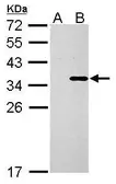 Anti-COL11A2 antibody used in Western Blot (WB). GTX128011