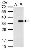 Anti-COL11A2 antibody used in Western Blot (WB). GTX128012