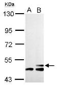 Anti-HMGCS2 antibody used in Western Blot (WB). GTX128013