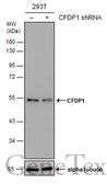 Anti-CFDP1 antibody used in Western Blot (WB). GTX128023
