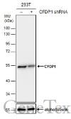Anti-CFDP1 antibody used in Western Blot (WB). GTX128024