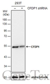 Anti-CFDP1 antibody used in Western Blot (WB). GTX128024