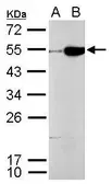 Anti-CFDP1 antibody used in Western Blot (WB). GTX128025