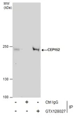 Anti-CEP152 antibody used in Immunoprecipitation (IP). GTX128027