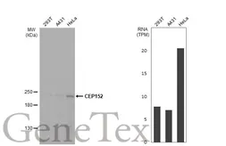 Anti-CEP152 antibody used in Western Blot (WB). GTX128027