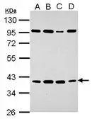 Anti-HEY2 antibody used in Western Blot (WB). GTX128029