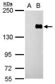 Anti-PREX1 antibody used in Western Blot (WB). GTX128037