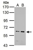 Anti-IKZF4 antibody used in Western Blot (WB). GTX128043
