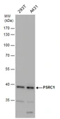 Anti-PSRC1 antibody used in Western Blot (WB). GTX128047