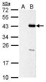 Anti-PSRC1 antibody used in Western Blot (WB). GTX128047