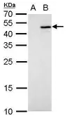 Anti-IL28B antibody used in Western Blot (WB). GTX128051