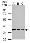 Anti-Connexin 40 antibody used in Western Blot (WB). GTX128055