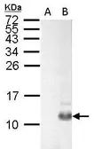 Anti-Pancreatic Polypeptide antibody used in Western Blot (WB). GTX128056