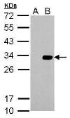 Anti-HSV tag antibody used in Western Blot (WB). GTX128058