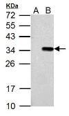 Anti-T7 tag antibody used in Western Blot (WB). GTX128059