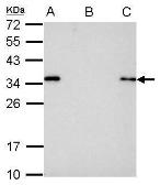Anti-S Tag antibody used in Immunoprecipitation (IP). GTX128060