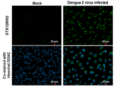 Anti-Dengue virus prM protein antibody used in Immunocytochemistry/ Immunofluorescence (ICC/IF). GTX128092