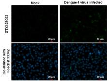 Anti-Dengue virus prM protein antibody used in Immunocytochemistry/ Immunofluorescence (ICC/IF). GTX128092
