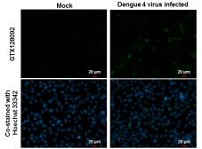 Anti-Dengue virus prM protein antibody used in Immunocytochemistry/ Immunofluorescence (ICC/IF). GTX128092