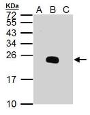 Anti-Dengue virus prM protein antibody used in Western Blot (WB). GTX128093