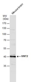 Anti-Wnt2 antibody used in Western Blot (WB). GTX128098
