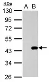 Anti-Wnt3 antibody used in Western Blot (WB). GTX128100