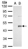 Anti-Wnt3a antibody used in Western Blot (WB). GTX128101