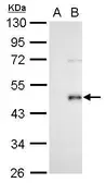 Anti-Wnt3a antibody used in Western Blot (WB). GTX128101