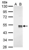 Anti-Wnt7a antibody used in Western Blot (WB). GTX128106