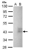 Anti-Wnt8b antibody used in Western Blot (WB). GTX128109