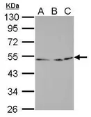 Anti-Egr2b antibody used in Western Blot (WB). GTX128131