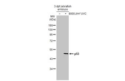 Anti-p53 antibody used in Western Blot (WB). GTX128135