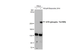 Anti-ATR (phospho Thr1989) antibody used in Western Blot (WB). GTX128145