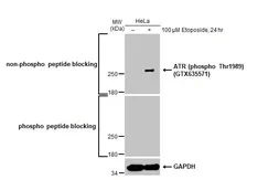 Anti-ATR antibody used in Western Blot (WB). GTX128146