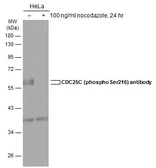 Anti-CDC25C (phospho Ser216) antibody used in Western Blot (WB). GTX128153