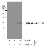 Anti-CDC2 (phospho Tyr15) antibody used in Immunoprecipitation (IP). GTX128155