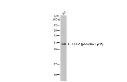 Anti-CDC2 (phospho Tyr15) antibody used in Western Blot (WB). GTX128155