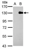 Anti-DNMT3A antibody used in Western Blot (WB). GTX128157